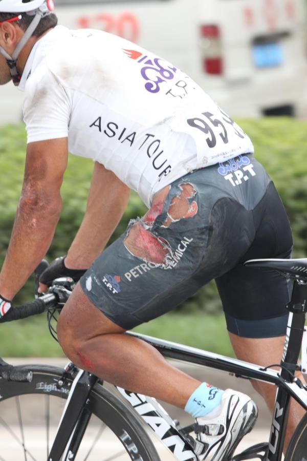 Dude, where's my knicks? This Tabriz Petrochemical rider was showing more than just skin after a nasty fall.