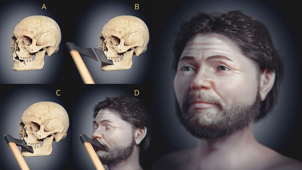 A collection of images showing a skull and the facial reconstruction of the deceased. 