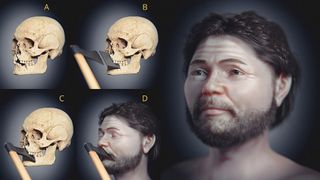 A collection of images showing a skull and the facial reconstruction of the deceased. 