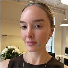 Hannah Baxter with a pimple patch