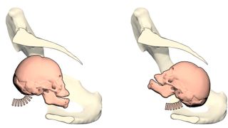 3D simulation of the birth canal of chimpanzees with (left) the fetal head in a fully extended position, the typical head alignment in apes, and (right) the fetal head in a fully flexed position, the usual head alignment in humans.