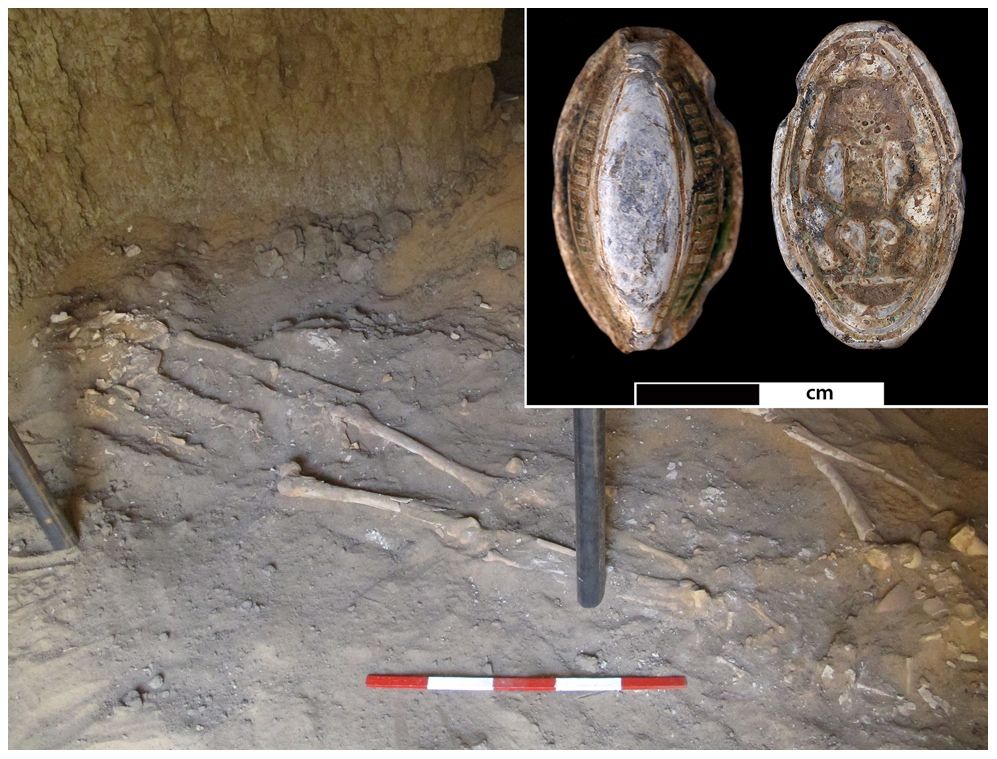 ancient egyptian skeleton with signs of earliest malignant cancer.