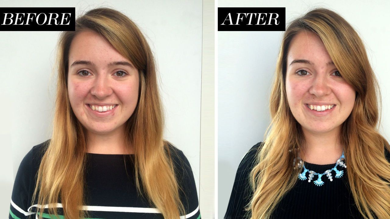 Quitting Sugar For A Week Effects On Skin Dietary Changes For Better 